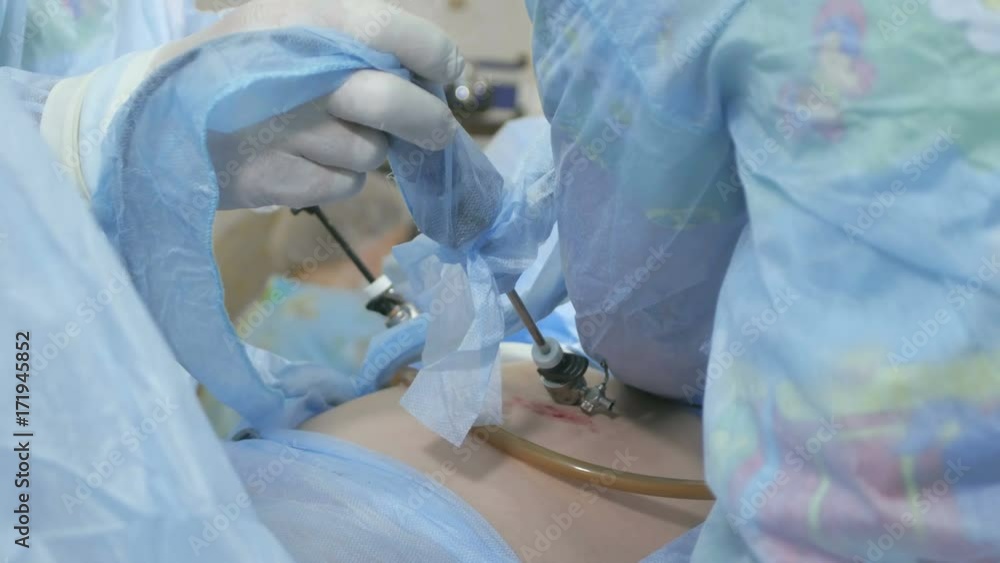 Operation using endoscopic equipment Operation using endoscopic equipment