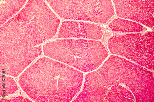 Valokuva Light micrograph of a liver showing hepatic lobules and portal areas