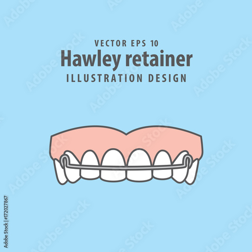 Hawley retainer illustration vector on blue background. Dental concept.