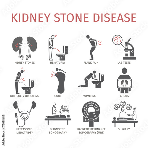 Kidney stones. Symptoms, Treatment. Icons set. Vector signs