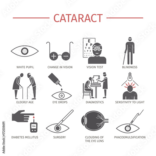 Cataract. Symptoms, Treatment. Icons set. Vector signs