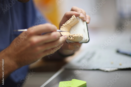 The process of manufacturing dentures in the dental laboratory photo