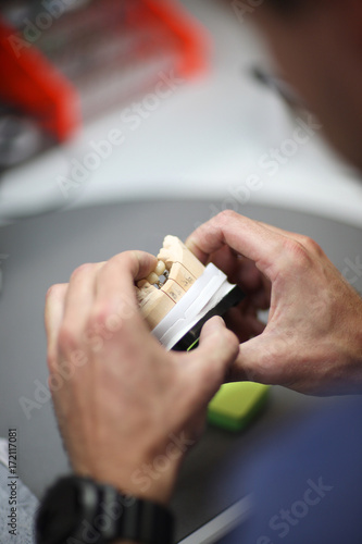 The hands of a dental technician in the process of manufacturing an individual denture
