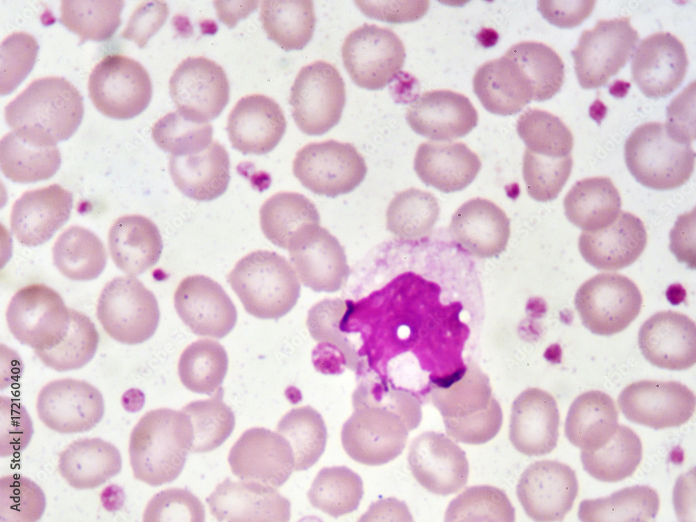 cell (white blood cell) in blood smear, analyze by microscope Stock Photo | Adobe