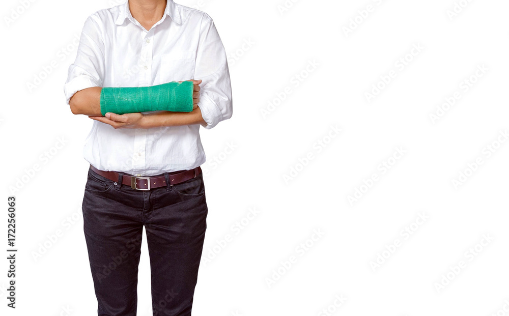female patient with a green cast on arm isolated on white, clipping path included, body injury concept female patient with a green cast on arm isolated on white, clipping path included, body injury concept