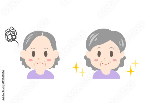 薄毛に悩むシニア女性のイラスト: ビフォーアフター