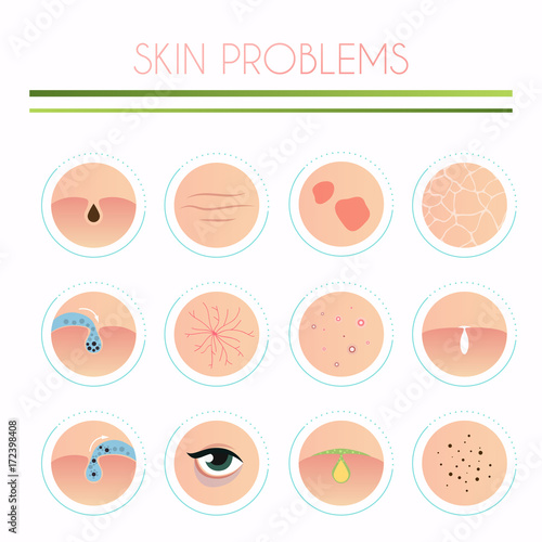 Skin problems solution, home remedies. Skincare and dermatology concept. Flat design modern vector illustration concept.