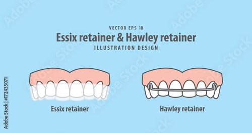 Essix retainer & Hawley retainer illustration vector on blue background. Dental concept.