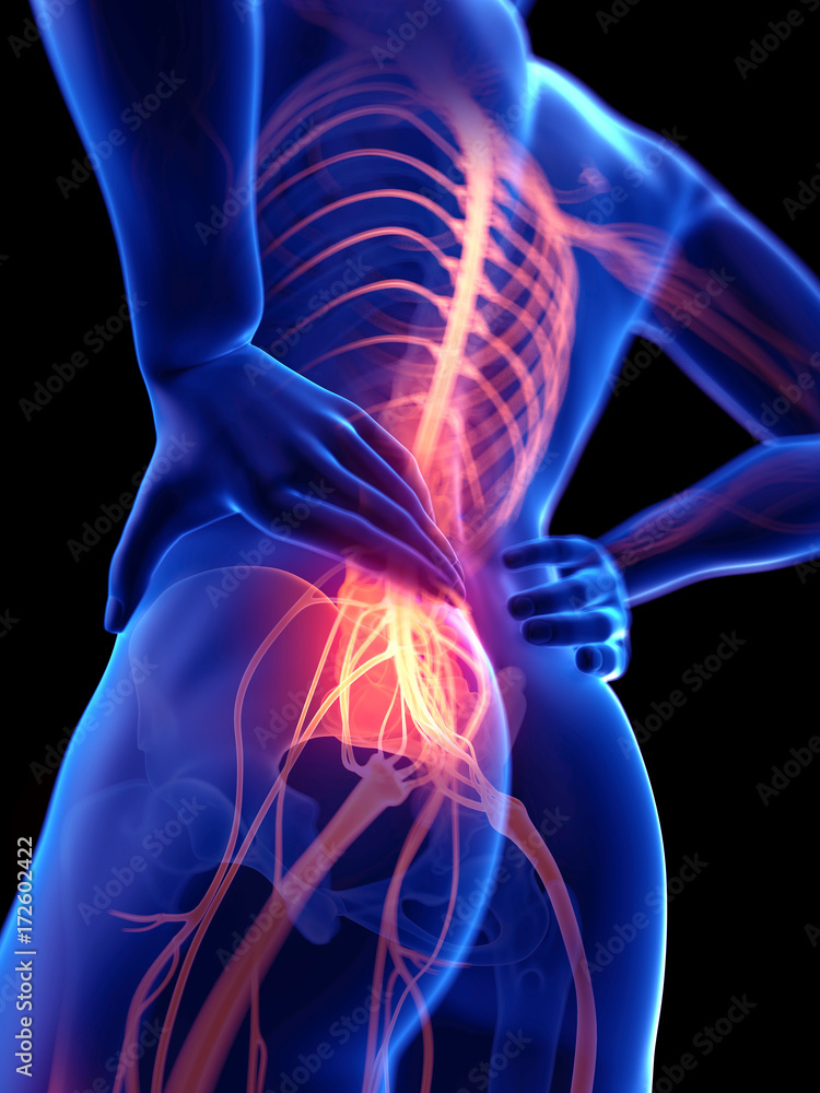 medically accurate 3d rendering of a guy with painful nerves medically accurate 3d rendering of a guy with painful nerves