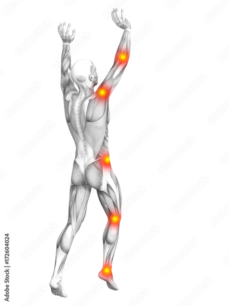 Conceptual human muscle anatomy with red and yellow hot spot inflammation or articular joint pain for health care therapy or sport concepts. 3D illustration man arthritis or bone osteoporosis disease Conceptual human muscle anatomy with red and yellow hot spot inflammation or articular joint pain for health care therapy or sport concepts. 3D illustration man arthritis or bone osteoporosis disease