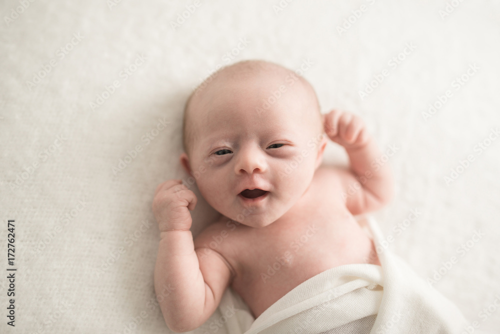 A Sweet Baby With Downs Syndrome Smiling At The Camera A Sweet Baby With Downs Syndrome Smiling At The Camera