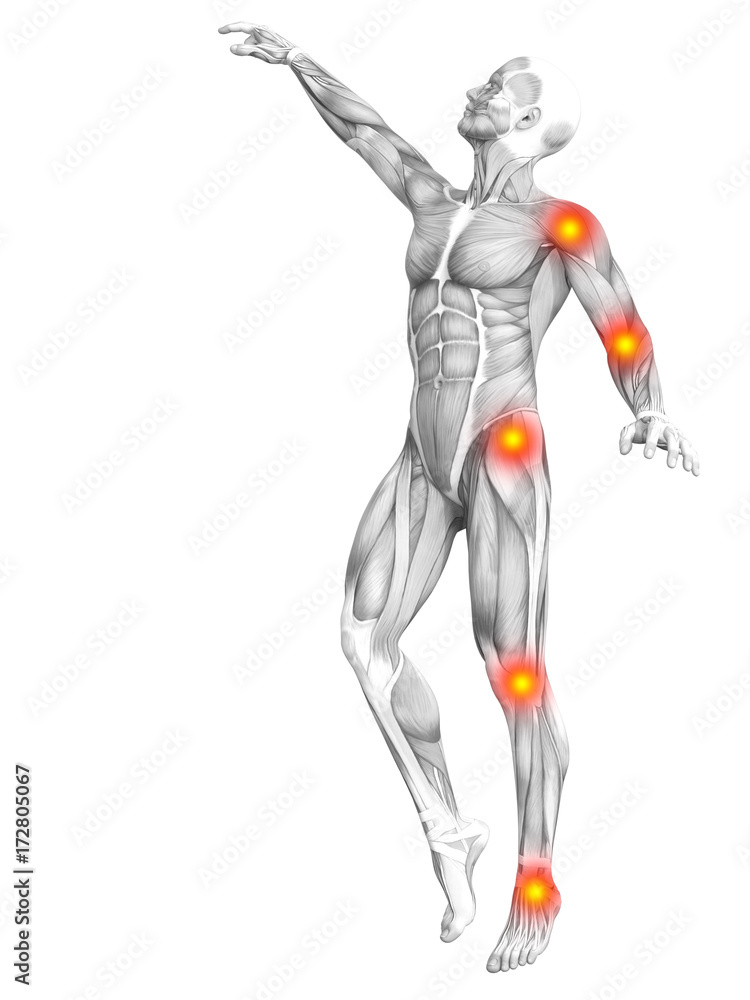 Conceptual human muscle anatomy with red and yellow hot spot inflammation or articular joint pain for health care therapy or sport concepts. 3D illustration man arthritis or bone osteoporosis disease