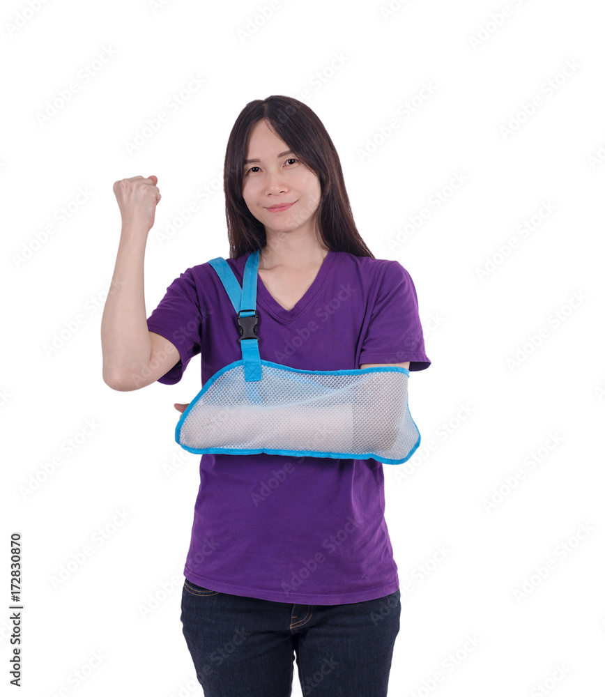 Asian lady in purple T shirt with broken arm Asian lady in purple T shirt with broken arm