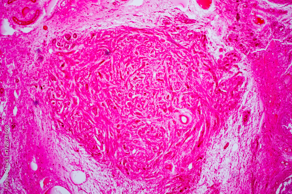 Cross section human ovary under microscope view. Stock Photo | Adobe Stock