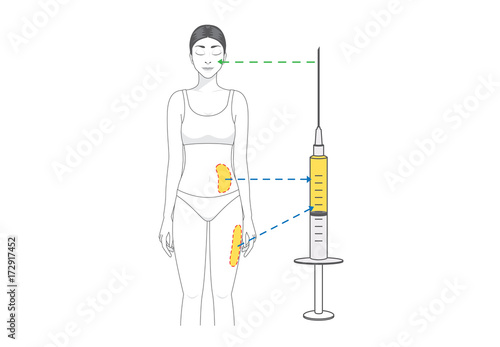 Beauty woman make fat transfer from buttocks to facial for wrinkles reduction. Illustration about Cosmetic surgery.