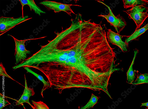 Fluorescence Microscope image of Bovine Pulmonary Artery Endothelial Cells BPAE stained for mitochondria, phalloidin, and nuclei undergoing mitosis photo