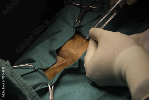 Photos A doctor injecting local anesthetic drug