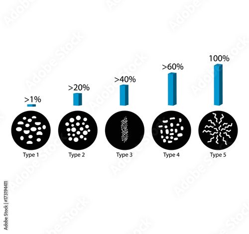 The probability of detecting breast cancer with different types of microcalcinates. Mammography. Infographics. Vector illustration on isolated background