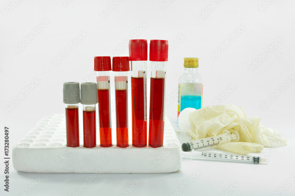 Blood sample in tube blood for screening test and syringe on white