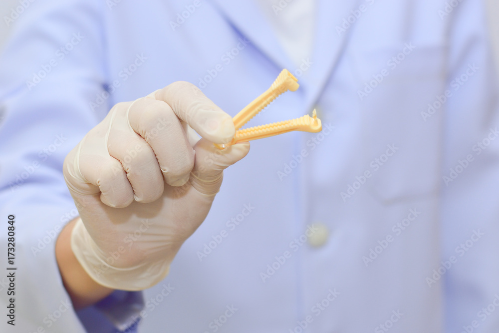 Yellow umbilical cord clamp used to clamp off the umbilical cord after