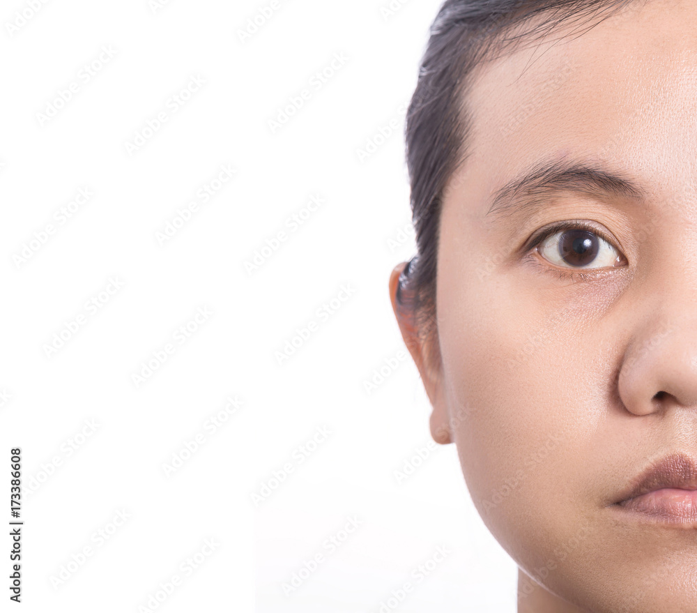 Asian woman showing face skin problem with big eyes bag, skin pore. Isolated on white background. Skin and health care concept Asian woman showing face skin problem with big eyes bag, skin pore. Isolated on white background. Skin and health care concept