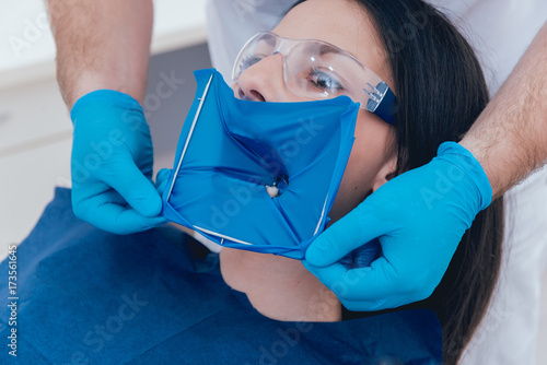 Dentistry cofferdam installation procedure. photo