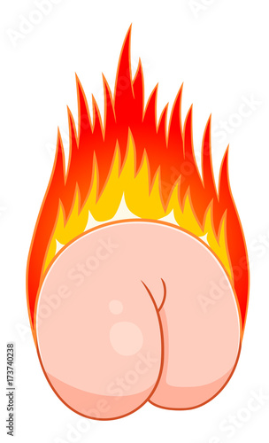 Burning butt