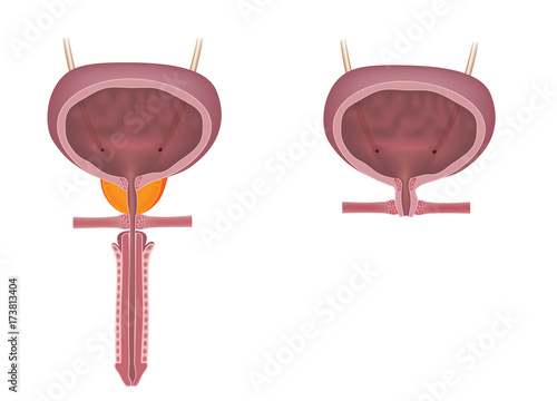 Male and female urinary systems, unlabeled.