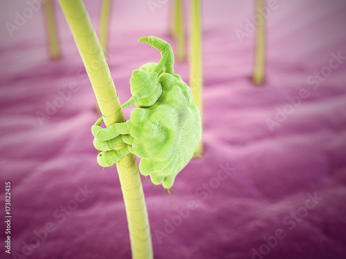 3d rendered medically accurate illustration of a pubic louse