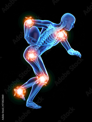 3d rendered medically accurate illustration of man with painful joints