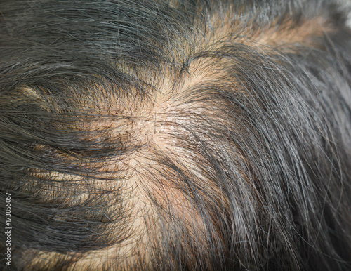 Konstfotografi thin hair in women