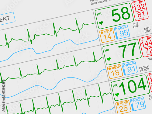Patient's vital signs on light ICU monitor, isolated closeup, dutched left