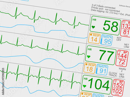 Patient's vital signs on light ICU monitor, isolated closeup, dutched right