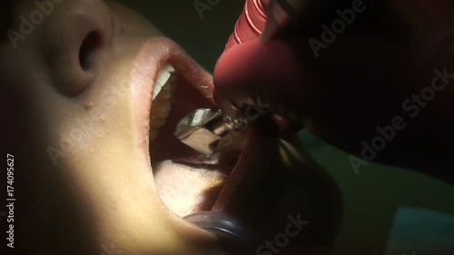 woman treats teeth from dentist photo