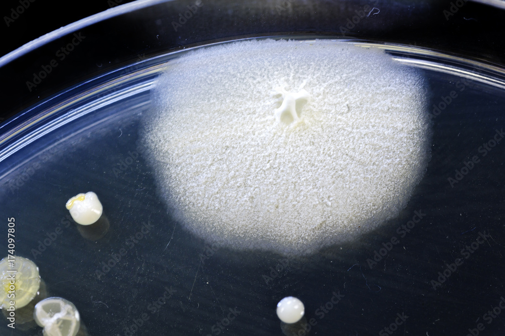 Different shaped colonies of bacteria, yeast and mold growing on agar