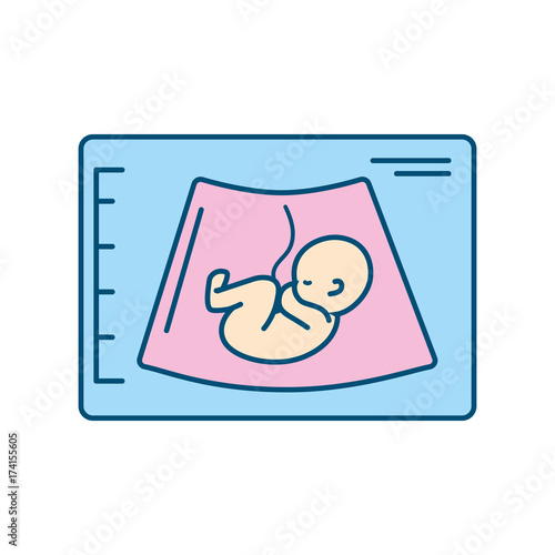 ultrasound of baby with umbilical cord