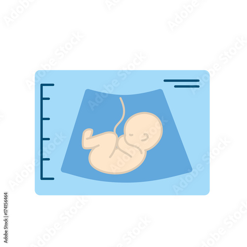 ultrasound of baby with umbilical cord
