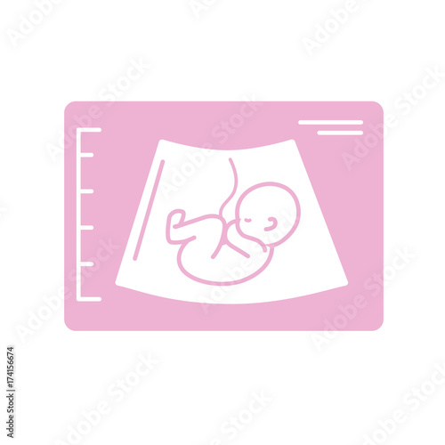 silhouette ultrasound of baby with umbilical cord