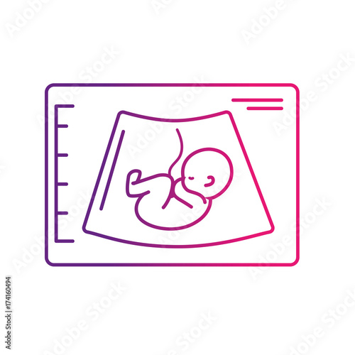 line ultrasound of baby with umbilical cord