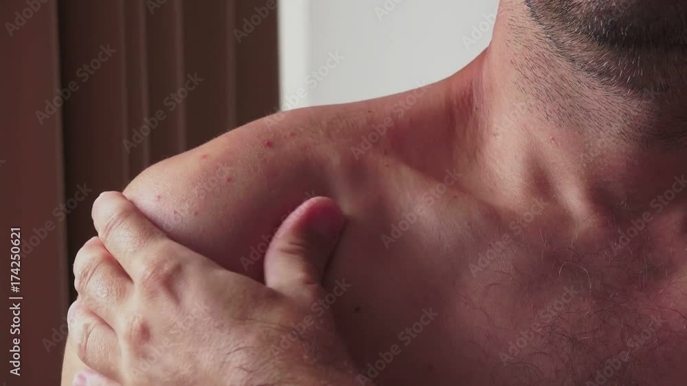 Pain symptoms - shoulder ache. Closeup of man feeling bad and ill, suffering from painful shoulder. Health care and medicine concepts. Pain symptoms - shoulder ache. Closeup of man feeling bad and ill, suffering from painful shoulder. Health care and medicine concepts.