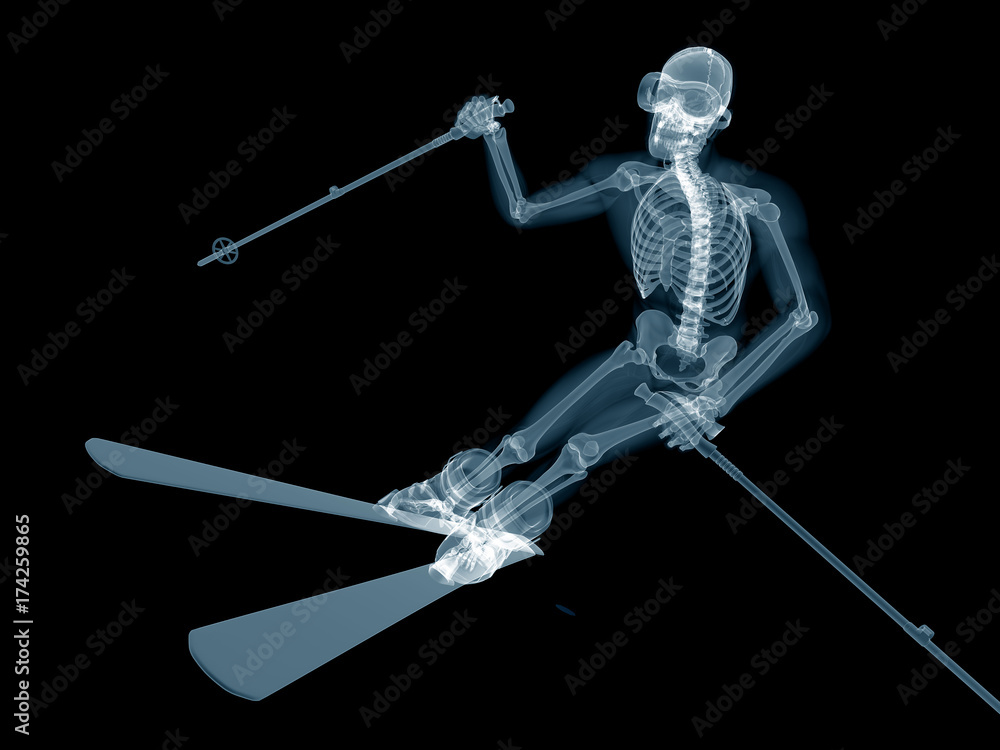 3d rendered medically accurate illustration of a skier 3d rendered medically accurate illustration of a skier