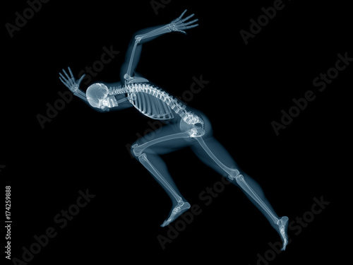 3d rendered medically accurate illustration of a sprinter x-ray photo