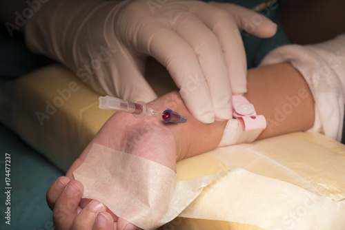 Doctor inserting the needle for arterial  line