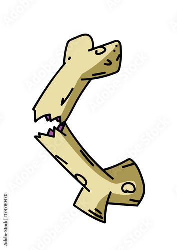Broken bone cartoon hand drawn image. Original colorful artwork, comic childish style drawing.