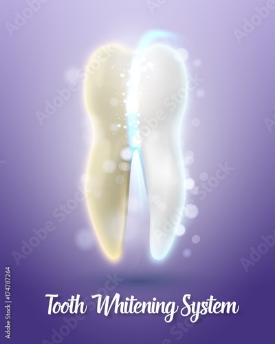 Illustration of Vector Teeth Cleaning Healthcare Stomatology Procedure. Realistic Vector Tooth Cleaning Process