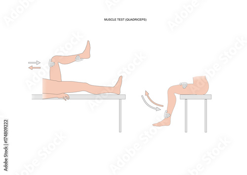 muscle test of the quadriceps femoris, or quads, used in kinesiology and neurology examination