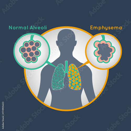 EMPHYSEMA vector logo icon illustration