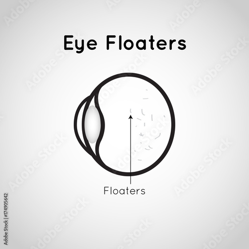 Eye Floaters logo vector icon design illustration