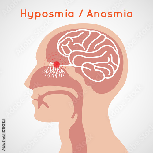 Hyposmia and Anosmia logo vector icon design illustration photo