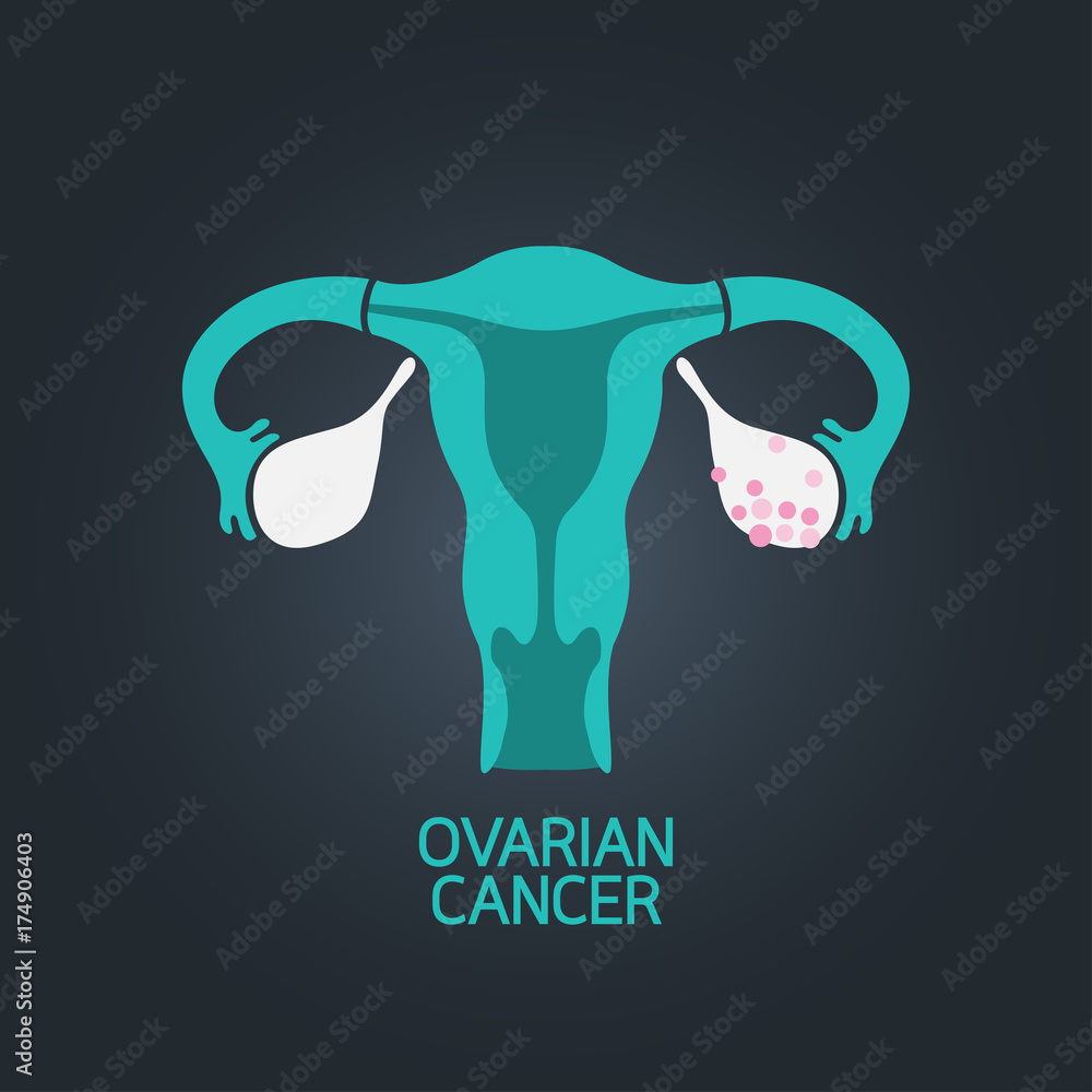 Ovarian Cancer vector logo icon illustration